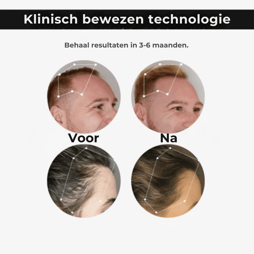 RejuvaCap™ Rood Licht Therapie Cap
