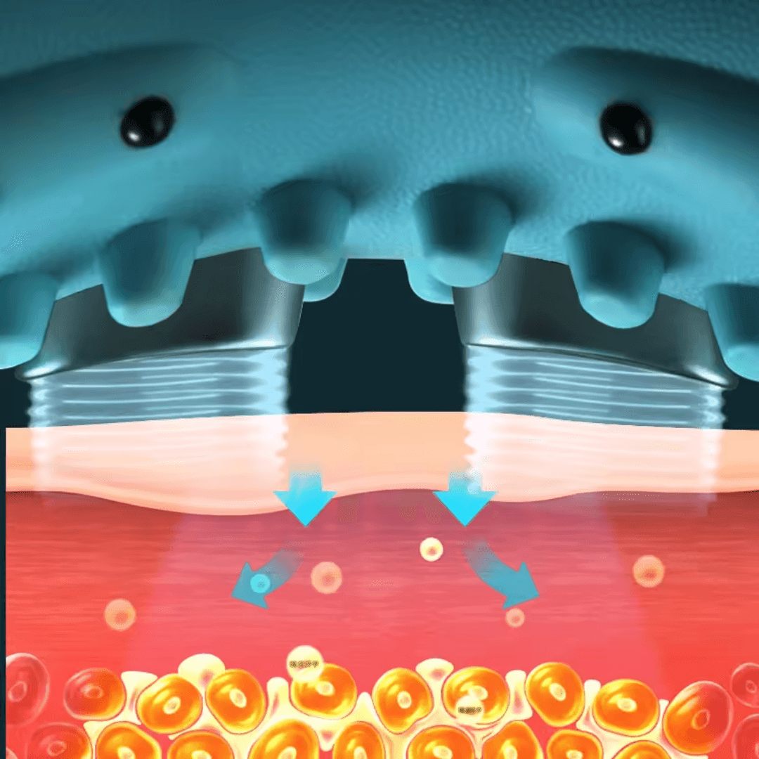 NeckRelief™ EMS Nekmassage Apparaat